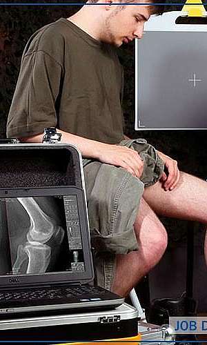 Raio x portátil digital	 Raio x portátil digital